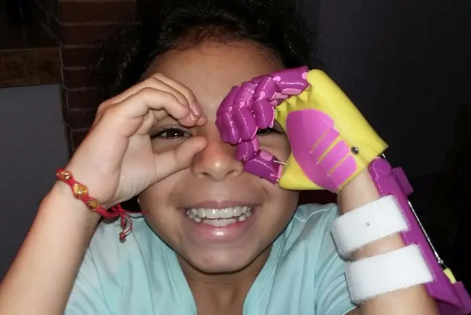 A new chapter in robotics: scrap-made prosthetics featured image